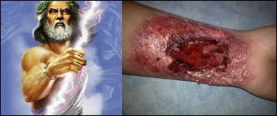 Tu dis que ton corps contient de « l'ichor » ? Doit-on te plaindre ou t'honorer ?
Que signifie le mot « ichor » ?