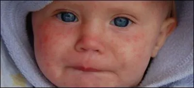 Au cours des 150 dernières années, cet autre fléau a fait 200 millions de victimes ; lequel ?