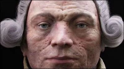 La petite vérole, est une infection virale extrêmement contagieuse et mortellement dangereuse, Louis XV d'ailleurs en est mort. Mais sous quel nom connaît-on cette maladie ?