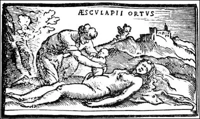 Dès l'antiquité, on pratiquait les césariennes lorsque la mère était morte.