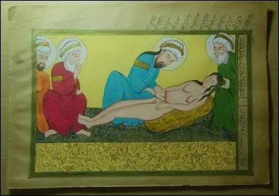 Jusqu'à la fin du XIX e siècle, les césariennes se terminaient dans un bain de sang.