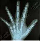 Grace  quoi, peut voir les os de cette main ?