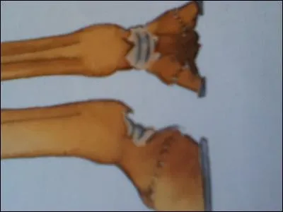 Quelle est cette blessure ?