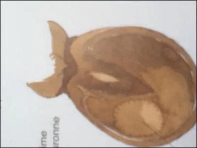 Quel est cette blessure ?