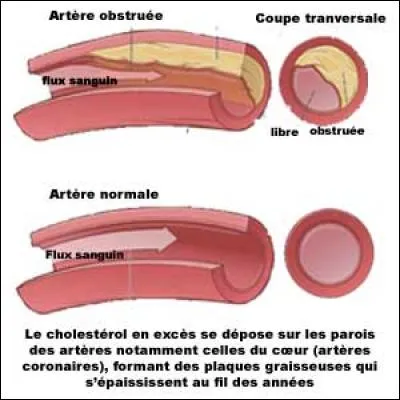Quel composant du vin augmente le taux sanguin du bon cholestérol, limite les dépôts dans les artères et fluidifie le sang ?