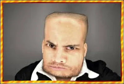 Après son accidant d'équitation, il a été mutilé : il a une bouille carrée !