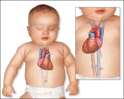 Le pouls normal d'un nourrisson est d'environ 80 pulsations par minute. Est-ce vrai ou faux ?