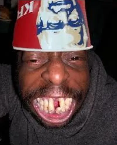 En langage populaire, comment nomme-t-on cet écartement fort visible entre deux dents de la mâchoire supérieure ou inférieure ?