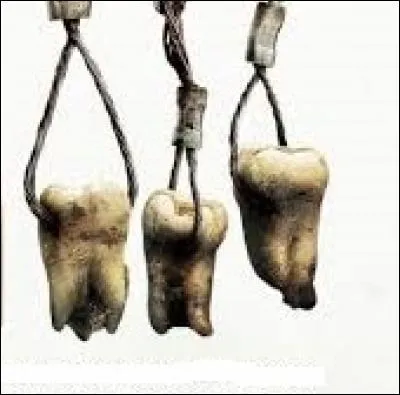 Pour éviter certains soucis futurs, principalement à cause de l'espace dont elles ont besoin pour leur éruption, beaucoup de personnes se font extraire ces molaires portant le nom de :