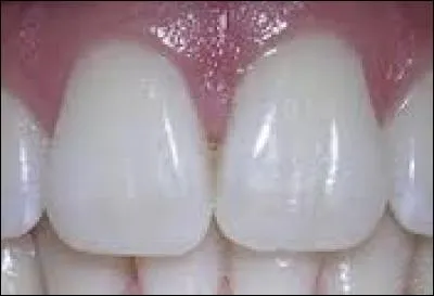 - En effet, bravo. Bon, nous allons y aller. Faites attention, après les lèvres il y a un trou donnant directement sur les dents. Voilà, c'est bon, passez... Nous sommes face à des dents. Quelles sont-elles ?