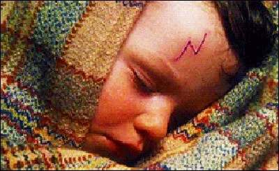 Pourquoi Harry Potter a-t-il une cicatrice sur son front ?