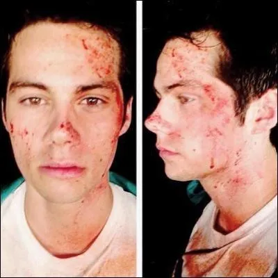 Quand s'est-il blessé sur le tournage de "Labyrinthe 3" ?