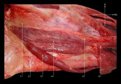 Muscle buccinateur, où est il ?