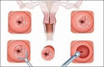 Quelle est cette partie féminine ?