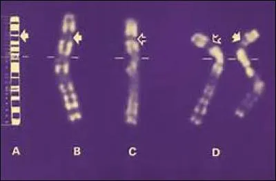 Datez la découverte du gène de la myopathie.