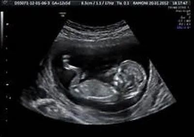 Échographies pour la surveillance de la grossesse, scanner, IRM (images reconstruites par ordinateur). Quelle décennie ces technologies évoquent-elles ?