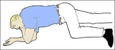 Cette personne se trouve-t-elle en position latérale de sécurité (ou PLS) ?