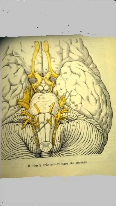 L'illustration au numéro VIII est :