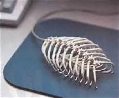 Vous savez tous ça, mais nous avons tout de même 206 os dans notre corps. À la naissance, nous en avions même...