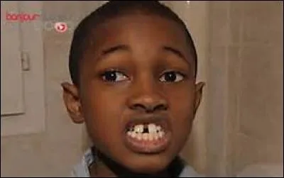 Laquelle de ces personnes a les dents du bonheur ?