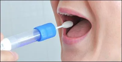 En 2004, combien le prix d'un test salivaire était-il ?