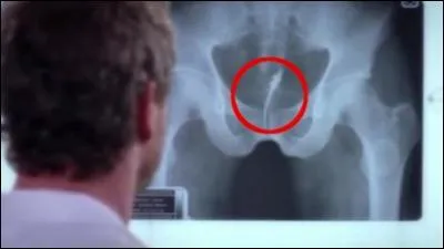 Monsieur, vous êtes en vacances et vous vous baignez dans une rivière amazonienne, personne autour, c'est bon vous pouvez faire votre petit pipi dans l'eau, erreur fatale, il remonte de votre urine jusque dans votre pénis, écarte ses épines, et là, vous appelez maman !