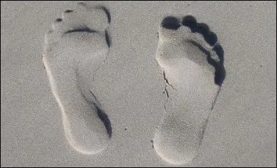 Malformation du pied qui apparait lors du développement ftal, quelle est la bonne orthographe ?