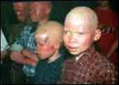 Ces garçonnets ont l'/le :