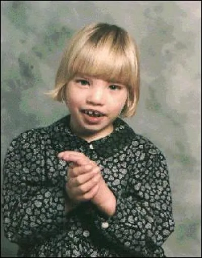 Quelle maladie cette fillette a-t-elle ?