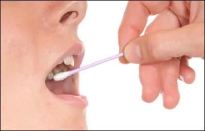 En principe, que prélève le médecin quand il prend un peu de votre salive avec un coton-tige ?