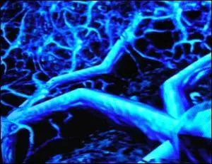 Qu'est-ce que c'est ?