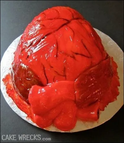 Quel est cet organe ?