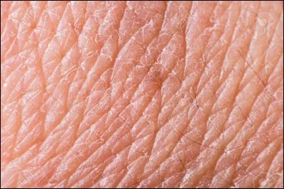 Durant notre vie, combien de kilos de peau perd-on ?
