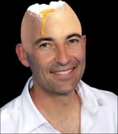 L'expression familière "Crâne d'uf" désigne une personne chauve. Mais que veut-elle dire de péjoratif ?