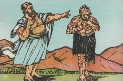 Quelle maladie infectieuse, due au bacille de Hansen, entraîne des lésions de la peau, des nerfs et des yeux ?