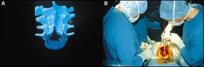Qu'est-ce qui peut désigner un ensemble de vaisseaux ou une structure osseuse composante des vertèbres ?