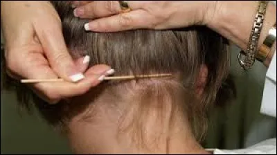 Les poux transmettent des maladies.