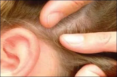 Les traitements préventifs sont utiles.