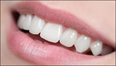 Une autre expression avec "dents", "avoir la dent dure". Que signifie-t-telle ?
