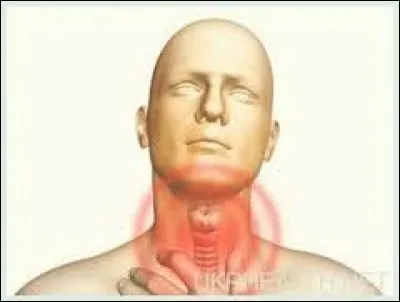 On peut l'avoir dans la gorge. Lequel ?