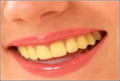 Sois honnête, comment sont tes dents, actuellement ?
