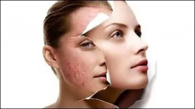 Si je vous dis : « Elle fait laide figure », vous répondez :