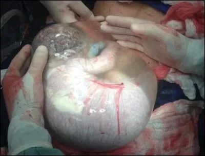 Que dit-on de ce bébé ?