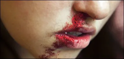 Quelqu'un a poussé ton ami et il saigne :