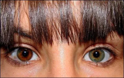Comment appelle-t-on le fait d'avoir des yeux de couleurs différentes ?